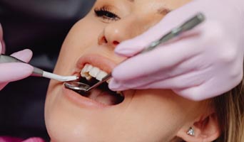 Deep Dental Cleaning: Do You Really Need It?