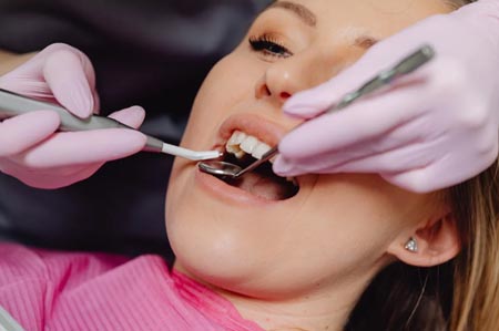 Deep Dental Cleaning: Do You Really Need It?
