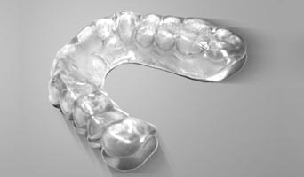 Are You A Candidate For Invisalign? 
