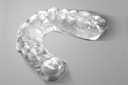 Are You A Candidate For Invisalign?