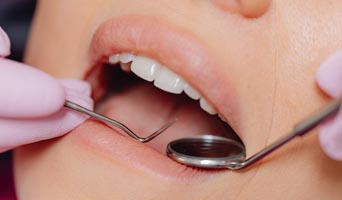 Benefits of Regular Teeth Cleaning Benefits of Regular Teeth Cleaning