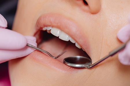 Benefits of Regular Teeth Cleaning