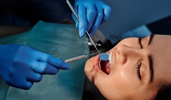 Comparing Periodontal Care & Regular Cleaning | Cathedral City Comparing Periodontal Care & Regular Cleaning | Cathedral City