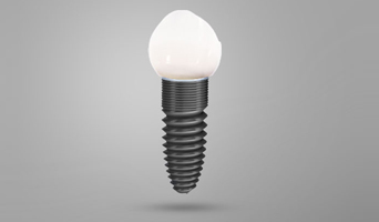 Emergency Tooth Replacement With Dental Implants In Cathedral City CA Emergency Tooth Replacement With Dental Implants In Cathedral City CA