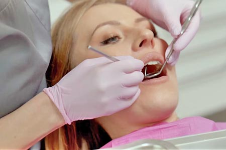 Deep Dental Cleaning: Do You Really Need It?