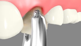 Oral Surgery